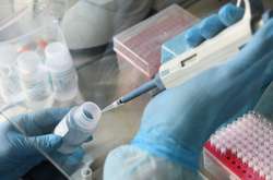  У 1003 закарпатців встановлено діагноз Covid-19 