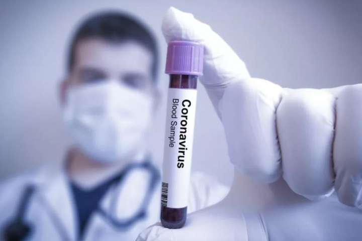 Итальянские медики обнаружили новый побочный эффект коронавирусной инфекции