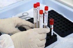 За останню добу в регіоні зареєстровано вісім нових випадків захворювання Covid – 19