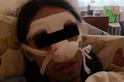 У лікарні  трансгендерній  жінці зробили операцію