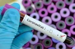 За сутки в Украине обнаружено 429 новых случаев Covid-19