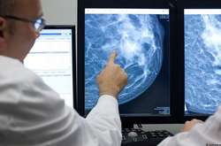 У Німеччині через коронавірус тимчасово припиняли розсилку запрошень на мамографію