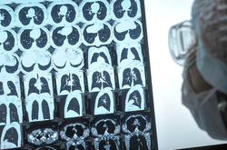 Вчений підкреслив, що про другу хвилю говорити поки рано, новий сплеск може статися у другій половині осені, він буде пов’язаний з поширенням інших ГРВІ