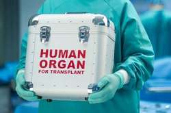 МОЗ створить новий підрозділ, який займатиметься питаннями трансплантації і лікування за кордоном 