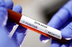 666 жителей Украины за сутки заразились Covid-19