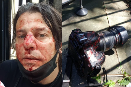 На акції протесту в Лондоні жорстоко побили італійського фотожурналіста