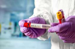 За прошедшие сутки коронавирусом заразились 48 украинских медработников