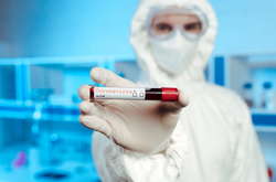 За добу коронавірус підтверджено у 43 киян