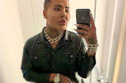 Британец, ставший двойником Ким Кардашьян, в два раза увеличил нижнюю губу (фото)