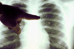 Станом на ранок 27 червня в Україні зафіксовано 948 нових випадків коронавірусу