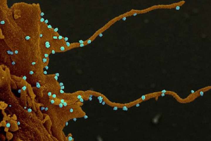 Вчені розповіли про «зловісні щупальця» коронавірусу