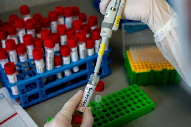 На Буковині виявили ще 44 випадки коронавірусу