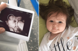 Невероятно густые волосы новорожденного малыша шокировали персонал роддома (фото)