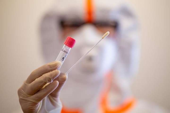 Український штам коронавірусу відрізняється від китайського, – науковець