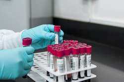 За время пандемии в Украине проведено 722 513 тестирований методом ПЦР