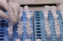 У Львові антитіла до коронавірусу виявили у 12% протестованих