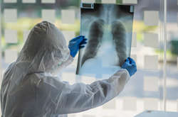 Наибольшее число случаев заражения коронавирусом зафиксировано в США