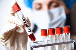 За время пандемии в стране проведено 803 657 тестирований методом ПЦР