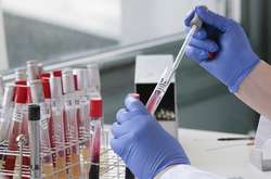 На достовірність результату впливає дотримання умов відбору та транспортування біологічного матеріалу до лабораторії