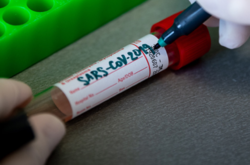 Рівень смертності від коронавірусу 83,7 на 1 млн жителів планети