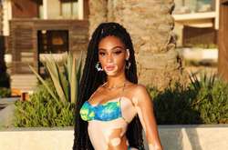 Модель с витилиго в бикини показала роскошное тело в честь дня рождения