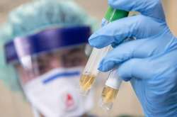 Загалом на сьогодні від початку пандемії захворіло 68 794 українців