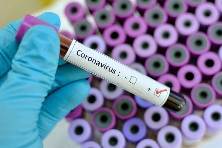 Третий раз подряд в Украине за сутки – более 1000 новых больных коронавирусом