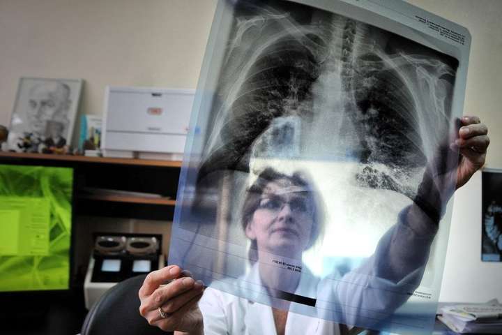Вчені відкрили механізм самознищення туберкульозу