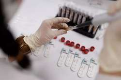  Станом на 3 серпня інтенсивний показник захворюваності на Covid-19 на Тернопільщині становить 298 випадків на 100 тис. населення 