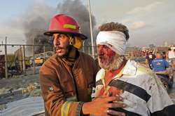 Тисячі постраждалих: лікарні Бейрута переповнені після вибуху