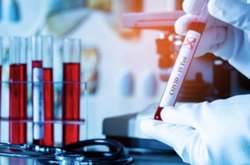 Київ і ще вісім регіонів не готові до послаблення карантину (список)