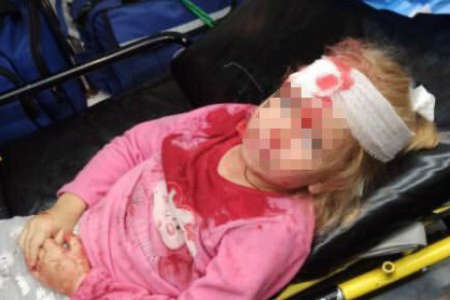 Внаслідок сутичок в Білорусі постраждала п’ятирічна дівчинка