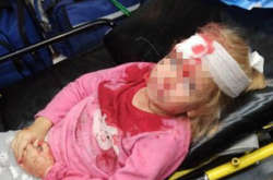 П'ятирічна дівчинка постраждала від нальоту омонвців у Білорусі