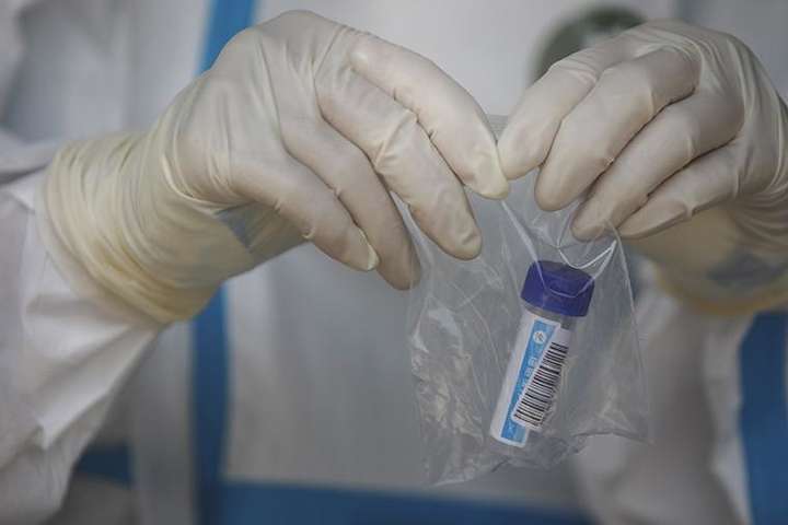 У США дозволили застосовувати новий тест на коронавірус за зразком слини
