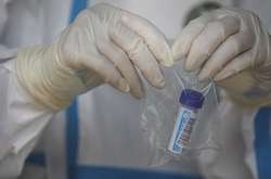 У США дозволили застосовувати новий тест на коронавірус