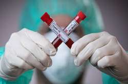 У Києві кількість нових випадків Covid-19 менша сотні