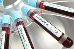 За добу у Києві виявлено понад півтори сотні нових випадків Covid-19