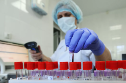 Вчені визначили фактор ускладнень і смерті від коронавірусу