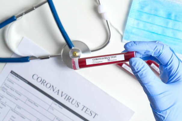 Коронавірус не відступає: на Буковині за добу виявили 158 нових випадків