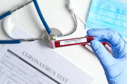 На Буковині за добу виявили 158 нових випадків