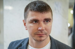 Депутат сам обратился за помощью в травмпункт