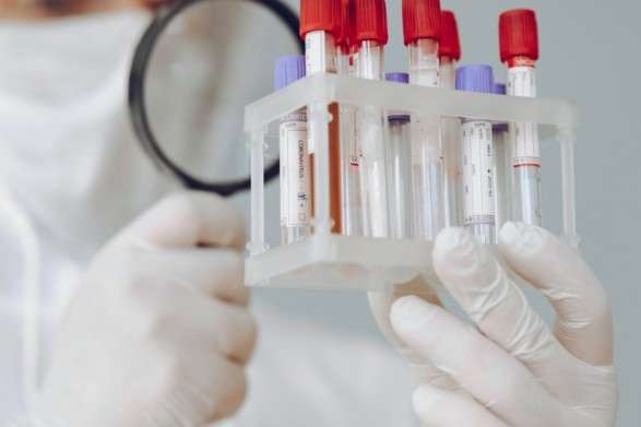 Одесити скаржаться на побори в лікарнях за непередбачені ПЛР-тести на коронавірус