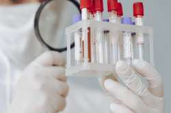 Одесити скаржаться на побори в лікарнях за непередбачені ПЛР-тести на коронавірус