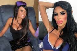 Как надувная кукла: 31-летняя медсестра сделала себе гигантские губы и грудь