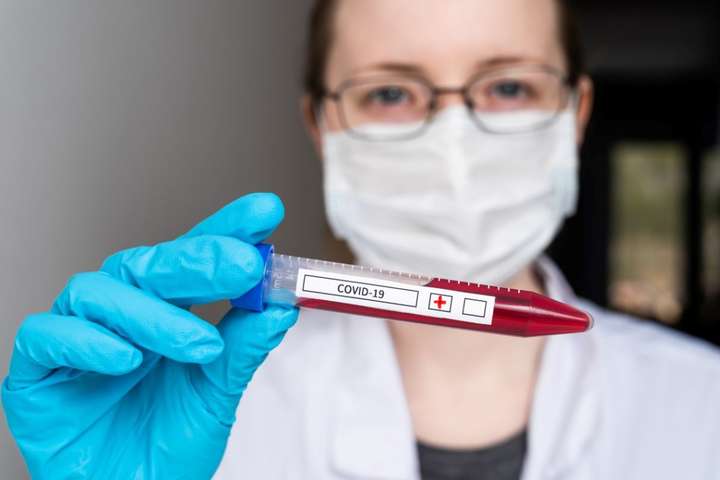 Вчені знайшли засіб, що захищає від коронавірусу