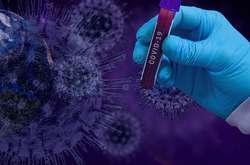 Оперативные данные МОЗ. За сутки выявлено 2174 новых больных Covid-19