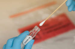 З початку роботи мобільні бригади вже відібрали понад 62 тисячі зразків