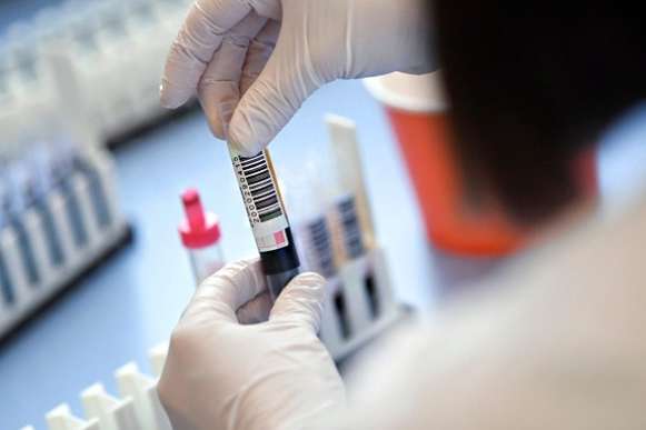Україна розробляє тест, що дозволить з одного зразка визначати грип чи Covid-19 у людини