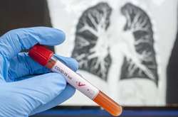 Кількість виявлених випадків Covid-19 зростає щодня