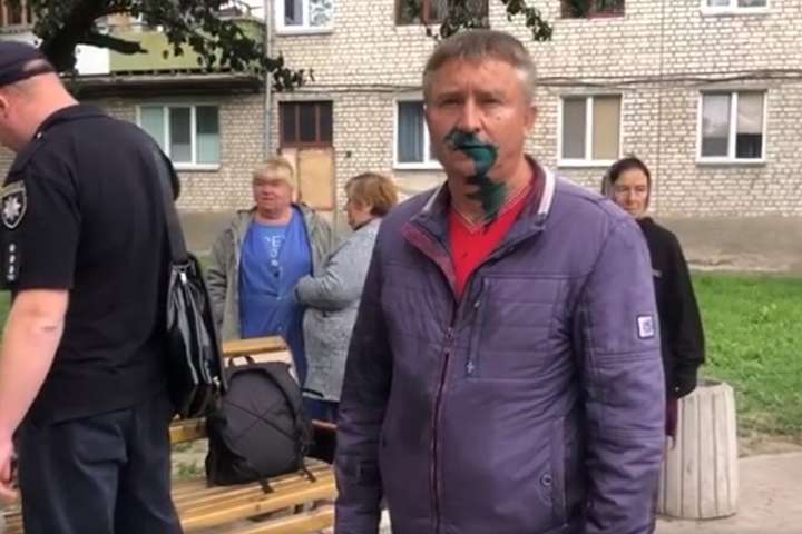 Депутата Житомирської міськради від Опоблоку облили зеленкою